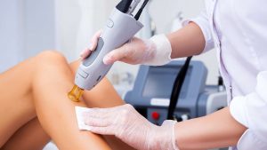 Is Laser Hair Removal Permanent