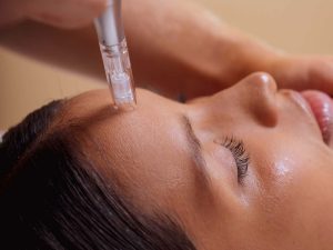 Why Microdermabrasion
